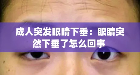 成人突發(fā)眼睛下垂：眼睛突然下垂了怎么回事 