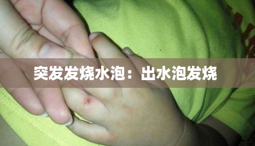 突發(fā)發(fā)燒水泡：出水泡發(fā)燒 