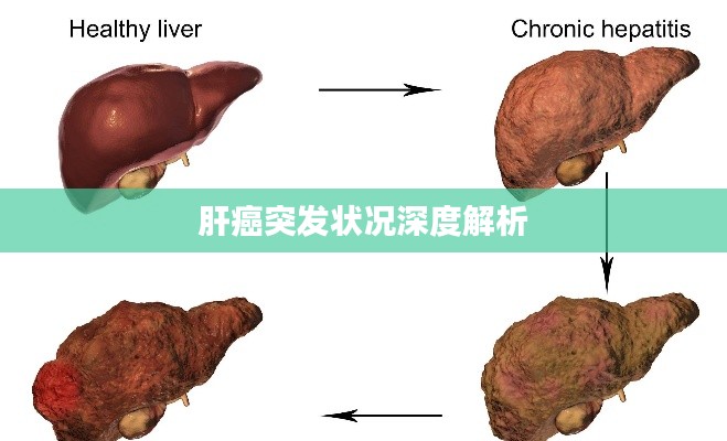 肝癌突發狀況深度解析