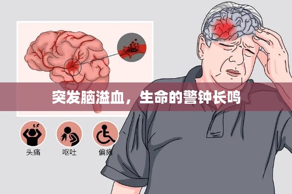 突發(fā)腦溢血，生命的警鐘長(zhǎng)鳴