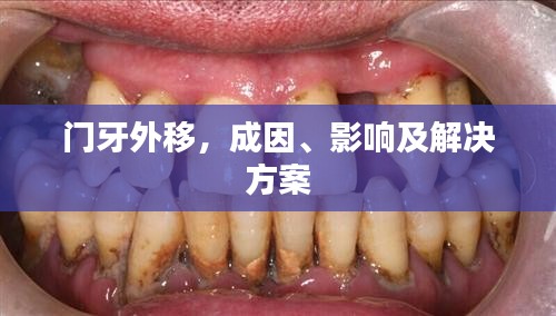 門牙外移，成因、影響及解決方案