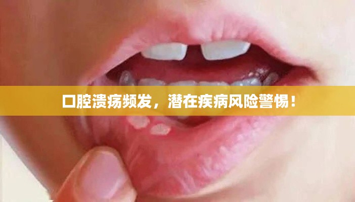 口腔潰瘍頻發(fā)，潛在疾病風(fēng)險(xiǎn)警惕！