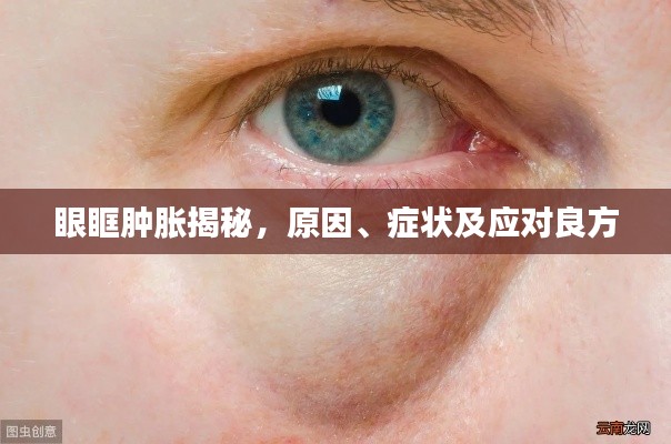 眼眶腫脹揭秘，原因、癥狀及應對良方