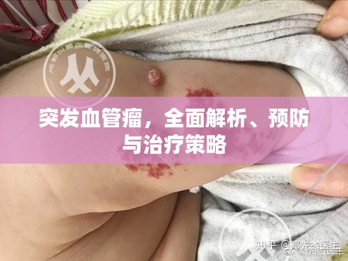突發(fā)血管瘤，全面解析、預防與治療策略